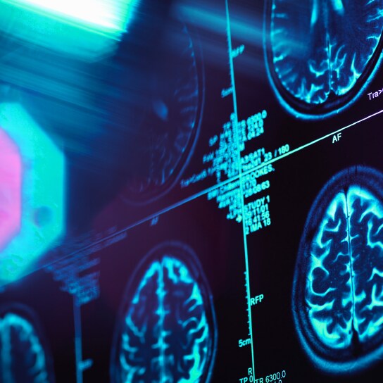 Une image d’IRM nette du cerveau
