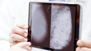 A mammogram image of a non-dense breast next to a mammogram image of a dense breast, demonstrating a clear difference.