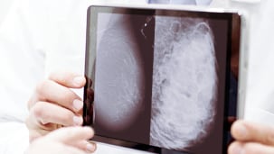 What Is Breast Density?